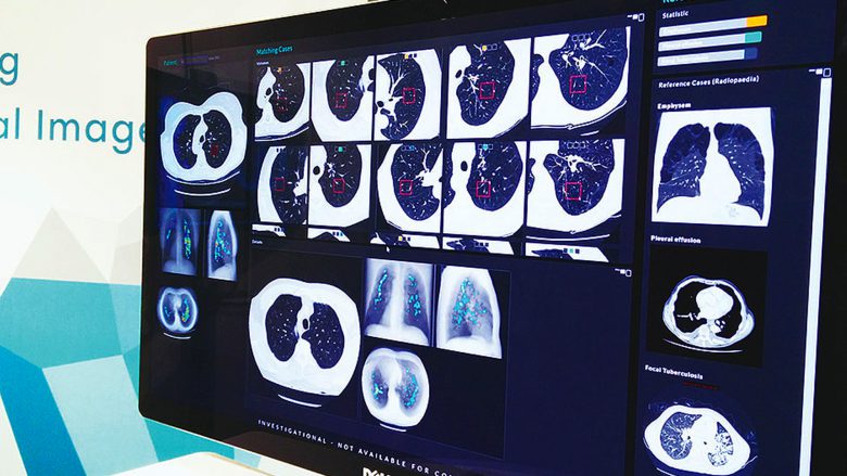 Radiologen sollen Hilfe dorch contextflow bekommen. © aws