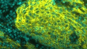 Menschliche Mandeln, dargestellt durch die MUSE-Plattform von arcoris bio © arcoris bio