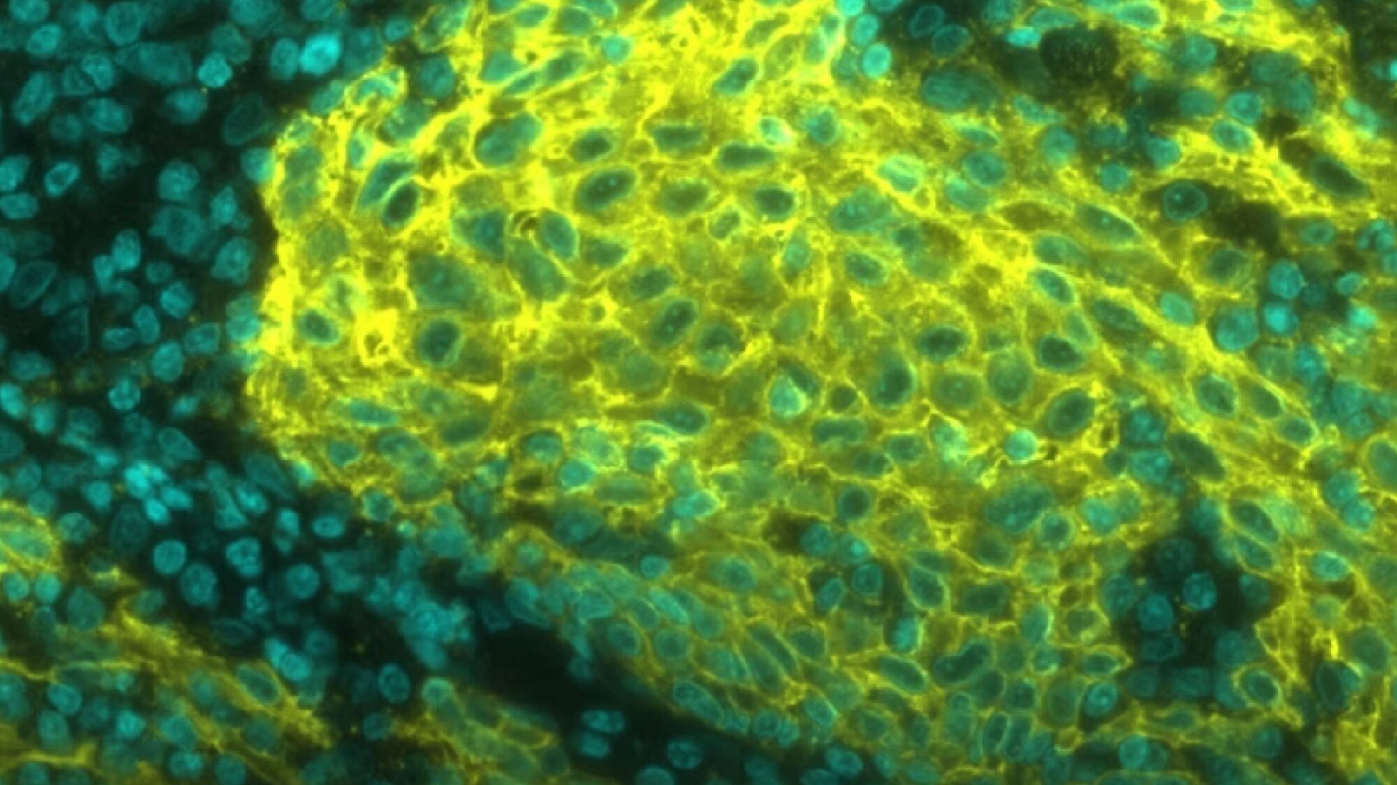 arcoris bio: Schweizer Biomarker-Startup sammelt 6,7 Millionen Euro ein